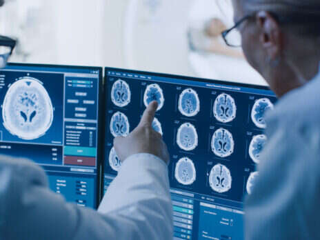 Automated image analysis: A route to transforming healthcare?